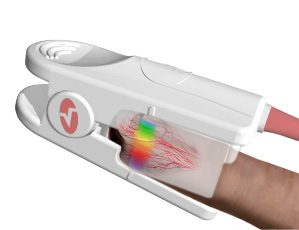 Hemoglobin Sensor