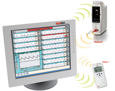 Remote Monitoring for General Floor and Emergency Rooms