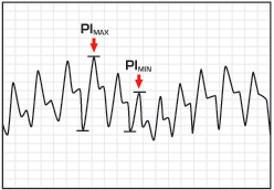 pvi graph pi min pi max