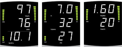 Rad-87 configuration options